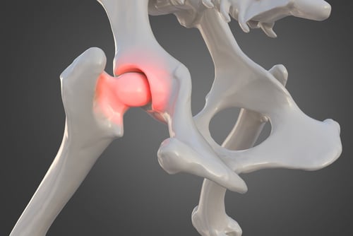 hip dysplasia in dogs happens when the ball and the socket grow at different rates