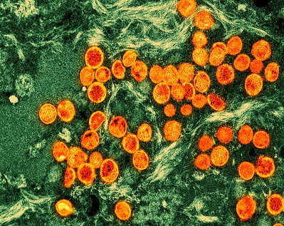 this collection of orange cells demonstrates what is monkeypox in animals