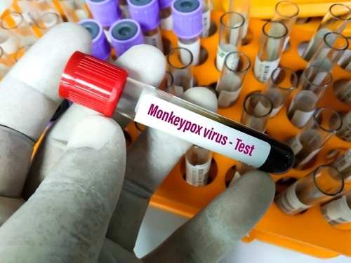 When exploring what is monkeypox laboratories need to do blood tests, as show in this collection of vials