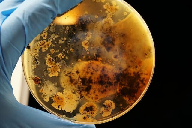 A petri dish.